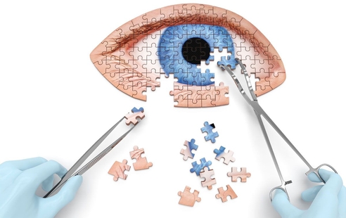 Как правильно ухаживать за контактными линзами? Как правильно ухаживать за контактными линзами?