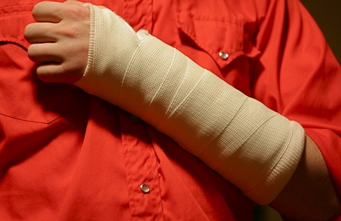 ФСС рассказал об оплате больничного, если сотрудник на срочном договоре получил травму в последний день работы