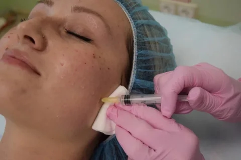 Реабилитация после биоревитализации: что можно и нельзя? Реабилитация после биоревитализации: что можно и нельзя?